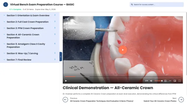Clinical demonstration video lesson showing an all-ceramic crown preparation.